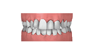 engstand kieferorthopäde grafing california smile maximilian schreiner