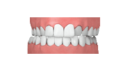 kreuzbiss kieferorthopäde grafing california smile maximilian schreiner