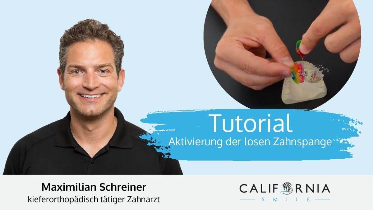 tutorial lose zahnspange grafing kieferorthopäde california smile maximilan schreiner